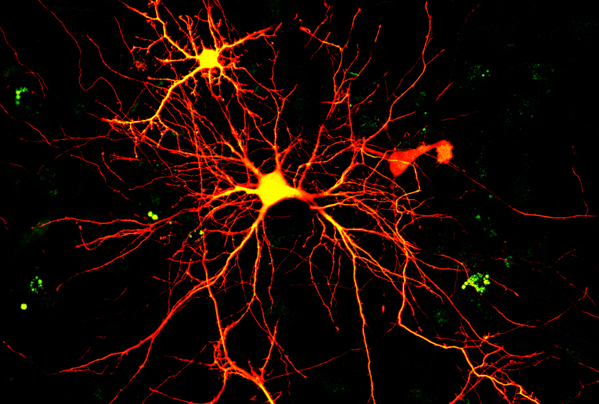 Switching neurons on and off to probe autism circuits | Spectrum