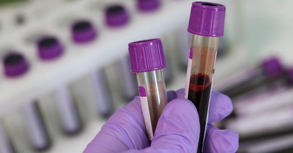 AI Nanotech Sensor Detects Cancer Signals in Blood